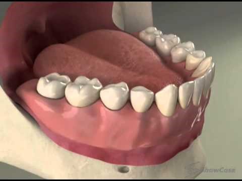 Dentures Problems Longdale OK 73755